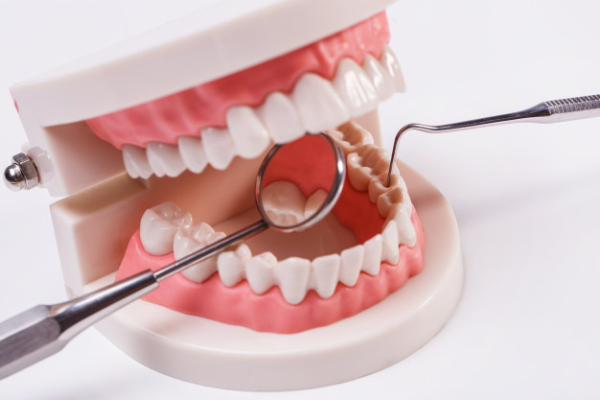 Sau khi dán sứ Veneer bạn cần chú ý chăm sóc răng miệng kỹ lưỡng