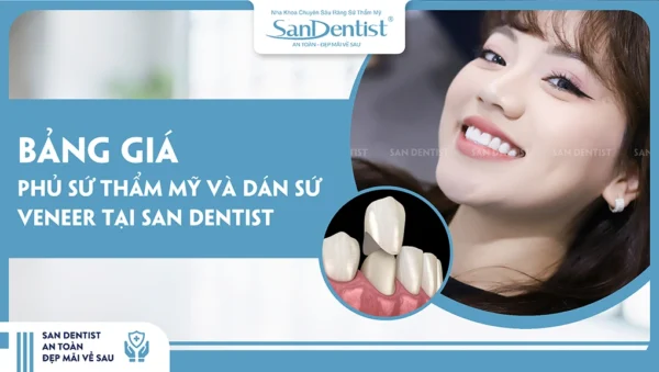 Bảng giá phủ sứ thẩm mỹ và dán sứ veneer tại San Dentist
