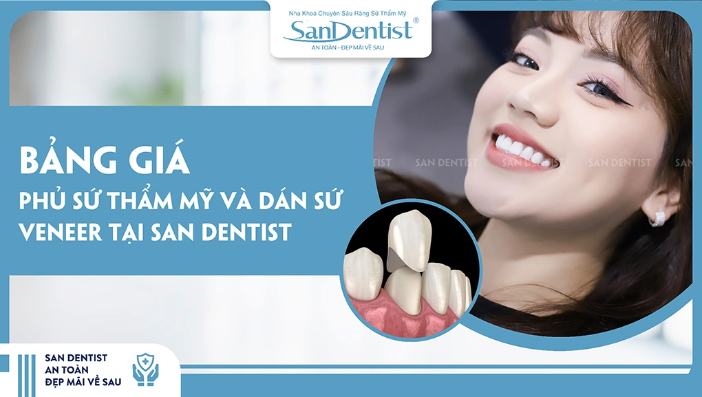 Bảng giá phủ sứ thẩm mỹ và dán sứ veneer tại San Dentist