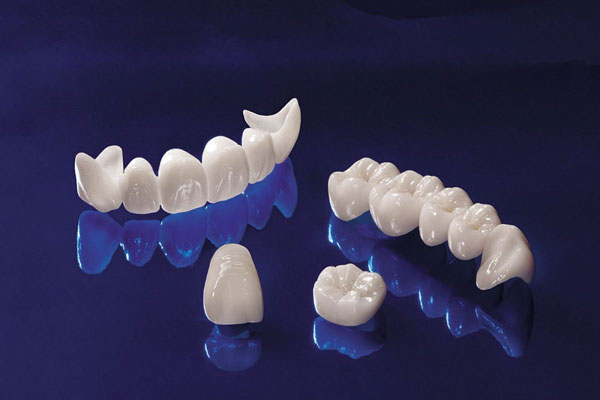 Phủ răng sứ che khuất những khiếm khuyết của răng gốc bằng cách sử dụng một mão sứ rất mỏng để phủ lên răng