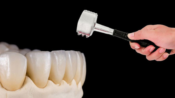 Răng sứ có độ bền từ 15 - 20 năm, thậm chí là trọn đời