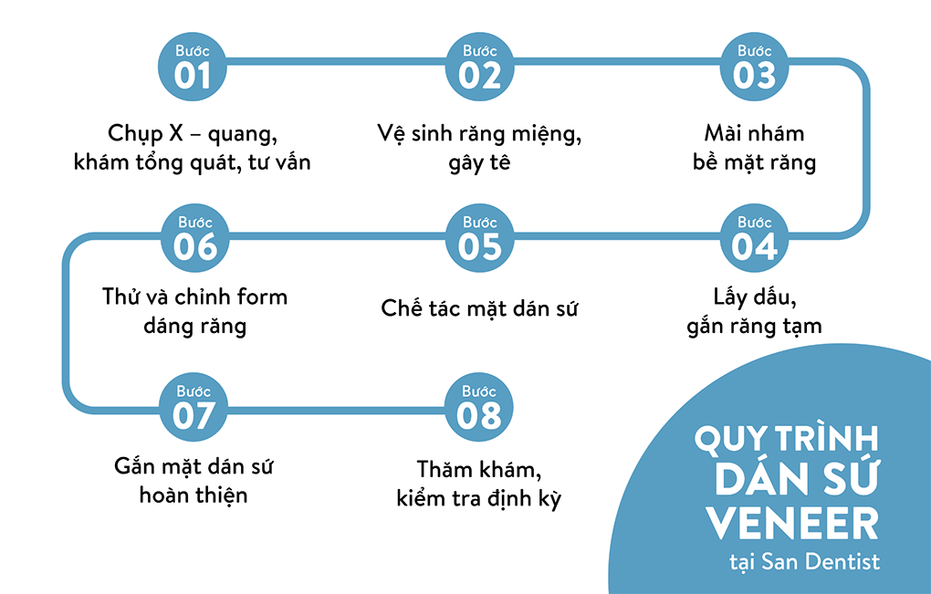 08 bước dán sứ Veneer chuẩn tại San Dentist