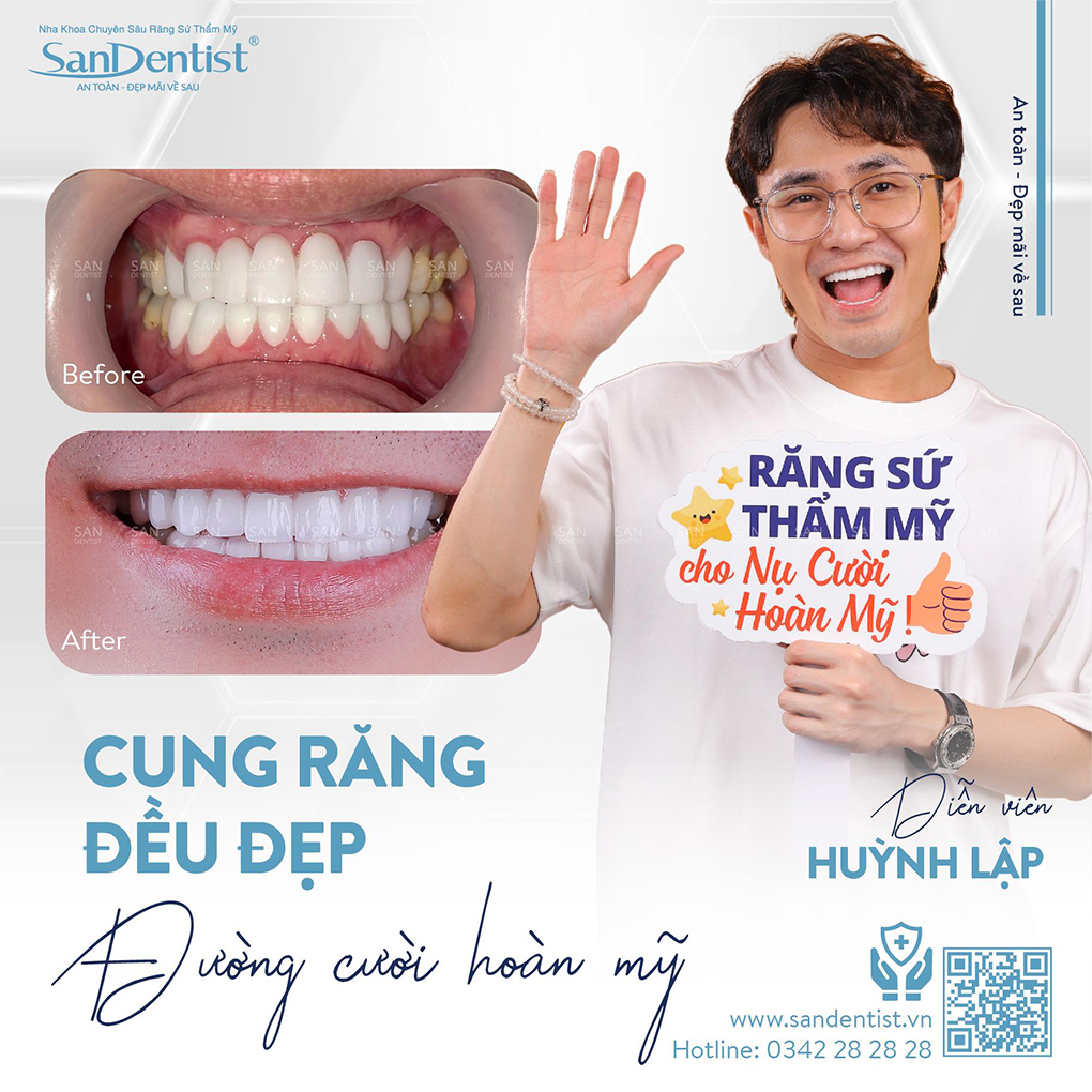 San Dentist là địa chỉ được nhiều khách hàng tin tưởng “chọn mặt gửi vàng”.