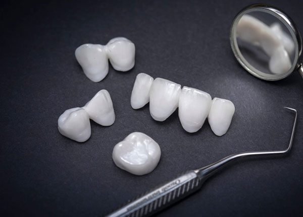 Phủ răng sứ - Giải pháp nha khoa hiện đại khắc phục các khuyết điểm răng