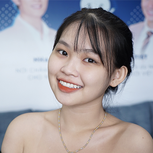 Bác sĩ ở đây làm rất nhẹ nhàng, tỉ mỉ, cảm giác không đau và về nhà ăn nhai tốt như răng thật.