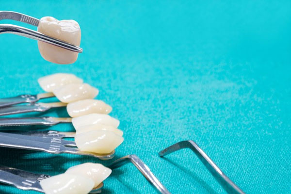 Số răng thực hiện cũng ảnh hưởng đến giá bọc răng sứ