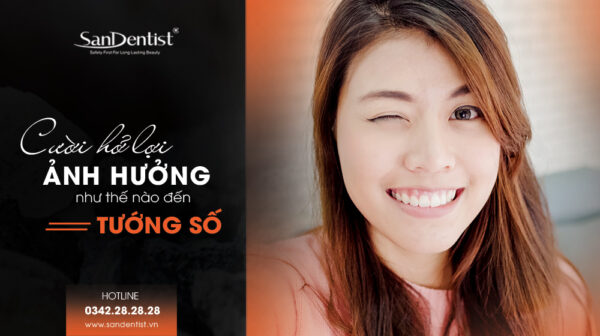 Cười hở lợi sướng hay khổ? Ảnh hưởng như thế nào đến tướng số?