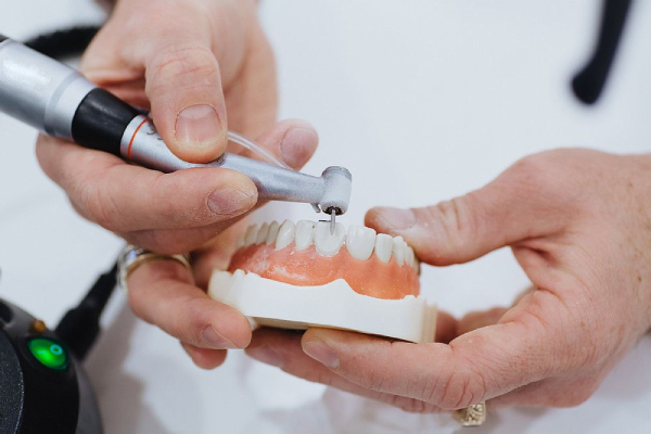 Phương pháp dán sứ Veneer chỉ mài nhẹ một lớp cực mỏng bên ngoài răng để tạo độ nhám