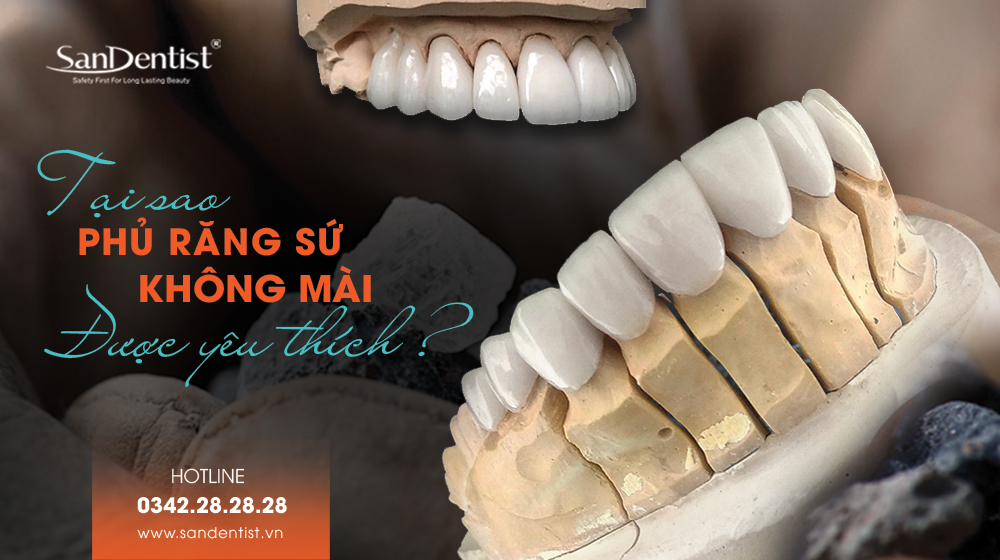 Tại sao phủ răng không mài được yêu thích?