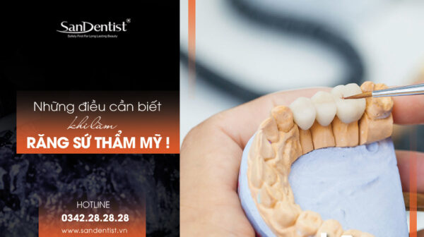 Răng sứ thẩm mỹ - Những điều cần biết khi làm!