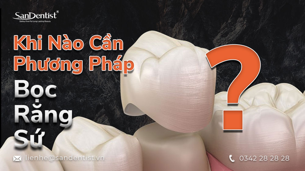 bọc răng sứ loại nào tốt nhất