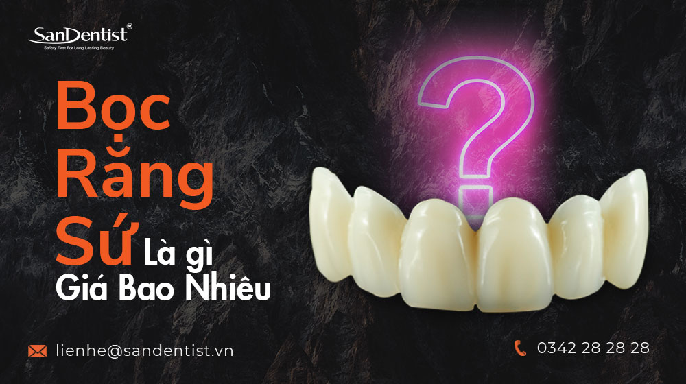 Bọc răng sứ là gì? Tuổi thọ của răng sứ giữ được bao lâu