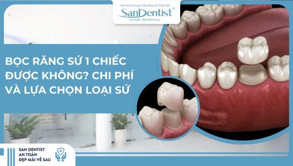 Bọc răng sứ 1 chiếc được không_ Chi phí và lựa chọn loại sứ