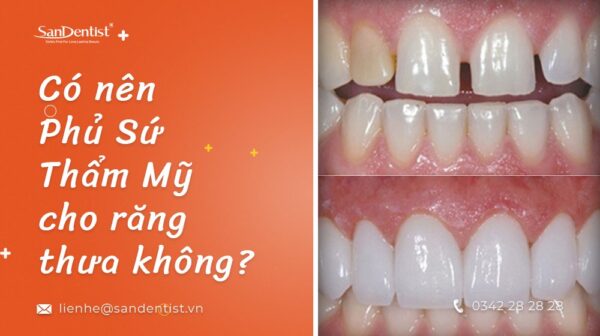 Có nên bọc răng sứ cho răng thưa không?