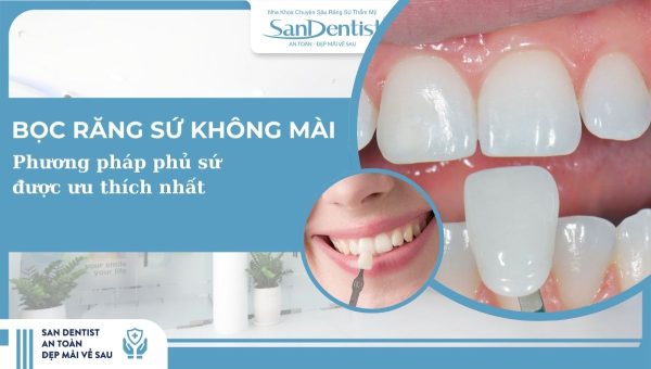 bọc răng sứ không mài