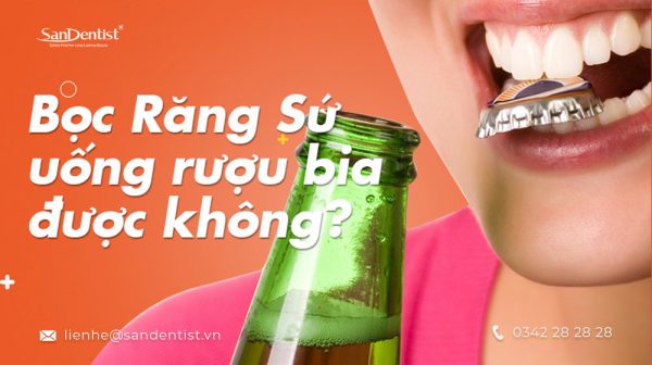 Bọc răng sứ uống bia được không? Những điều cần lưu ý khi bọc răng sứ