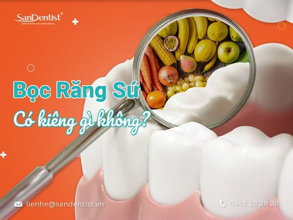Bọc răng sứ xong có kiêng gì không: Chế độ ăn tốt nhất cho người phủ sứ