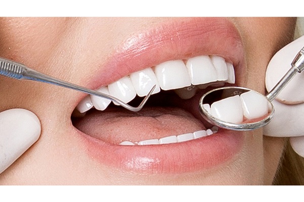 Bọc răng sứ và những điều cần biết - Chia sẻ từ chuyên gia