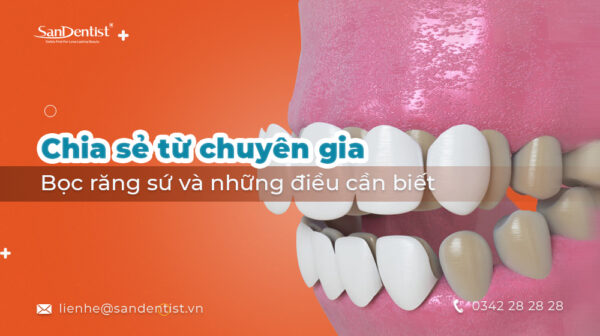 Bọc răng sứ và những điều cần biết - Chia sẻ từ chuyên gia