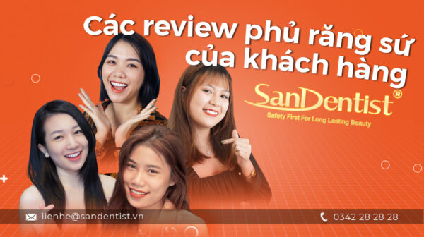 Khách hàng review về phương pháp phủ răng sứ thẩm mỹ tại nha khoa San Dentist