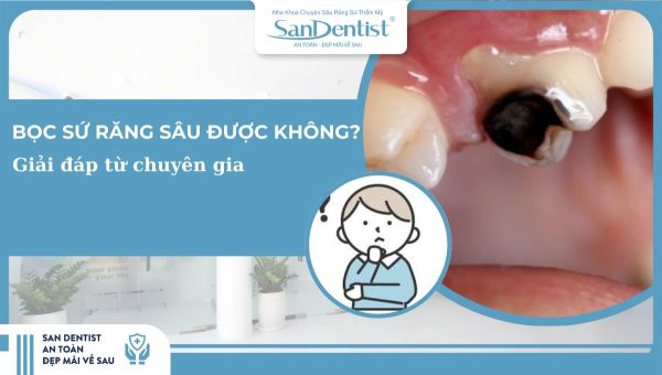Giải đáp từ chuyên gia_ Bọc sứ răng sâu được không