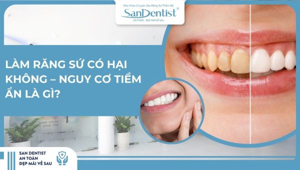 Làm răng sứ có hại không – Nguy cơ tiềm ẩn là gì