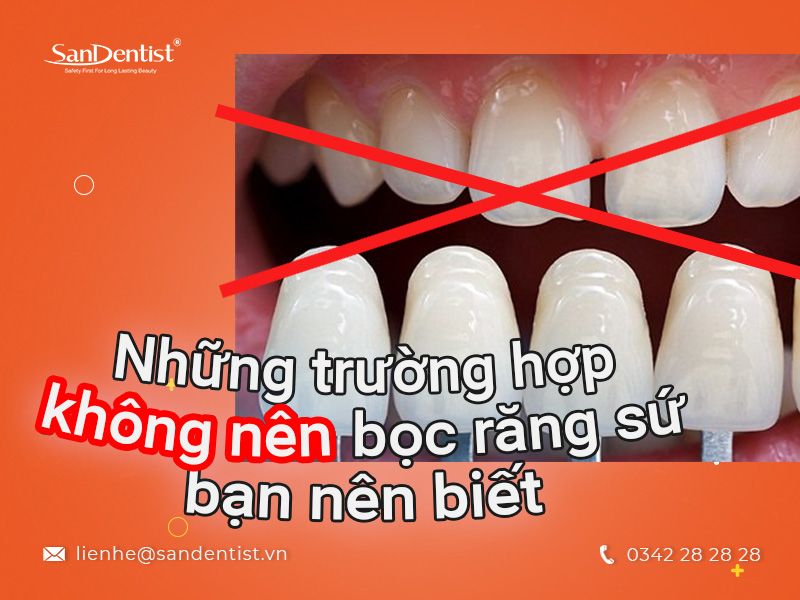 Những trường hợp không nên bọc răng sứ bạn nên biết