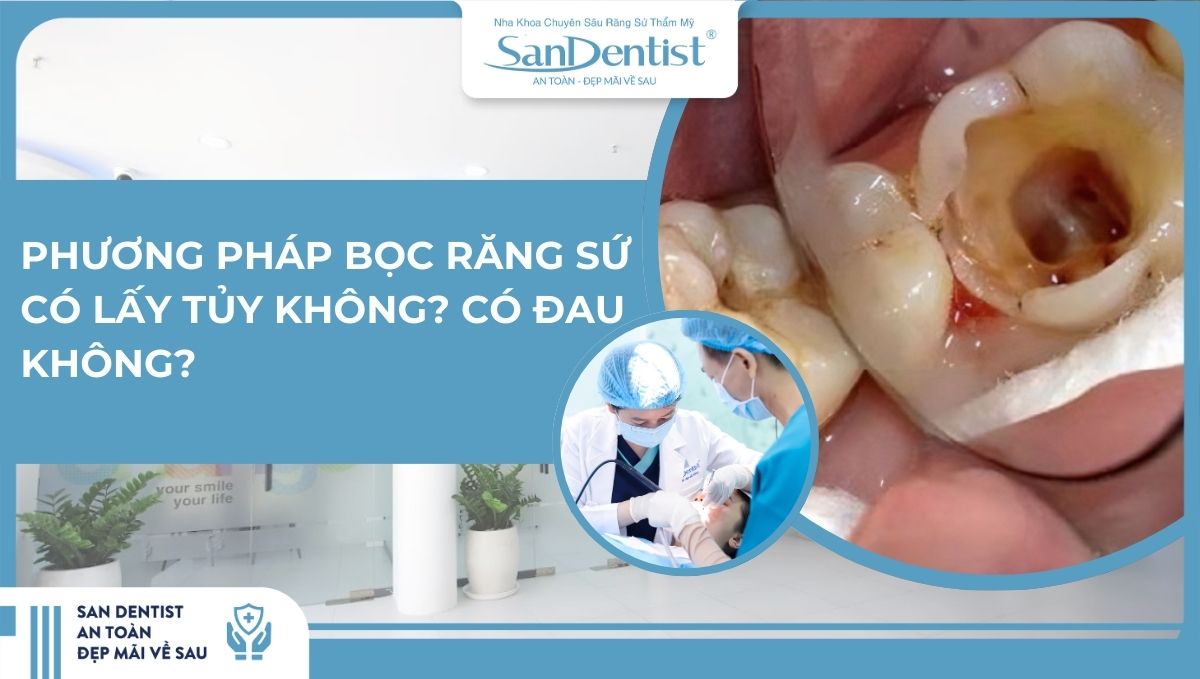 Phương pháp bọc răng sứ có lấy tủy không_ Có đau không