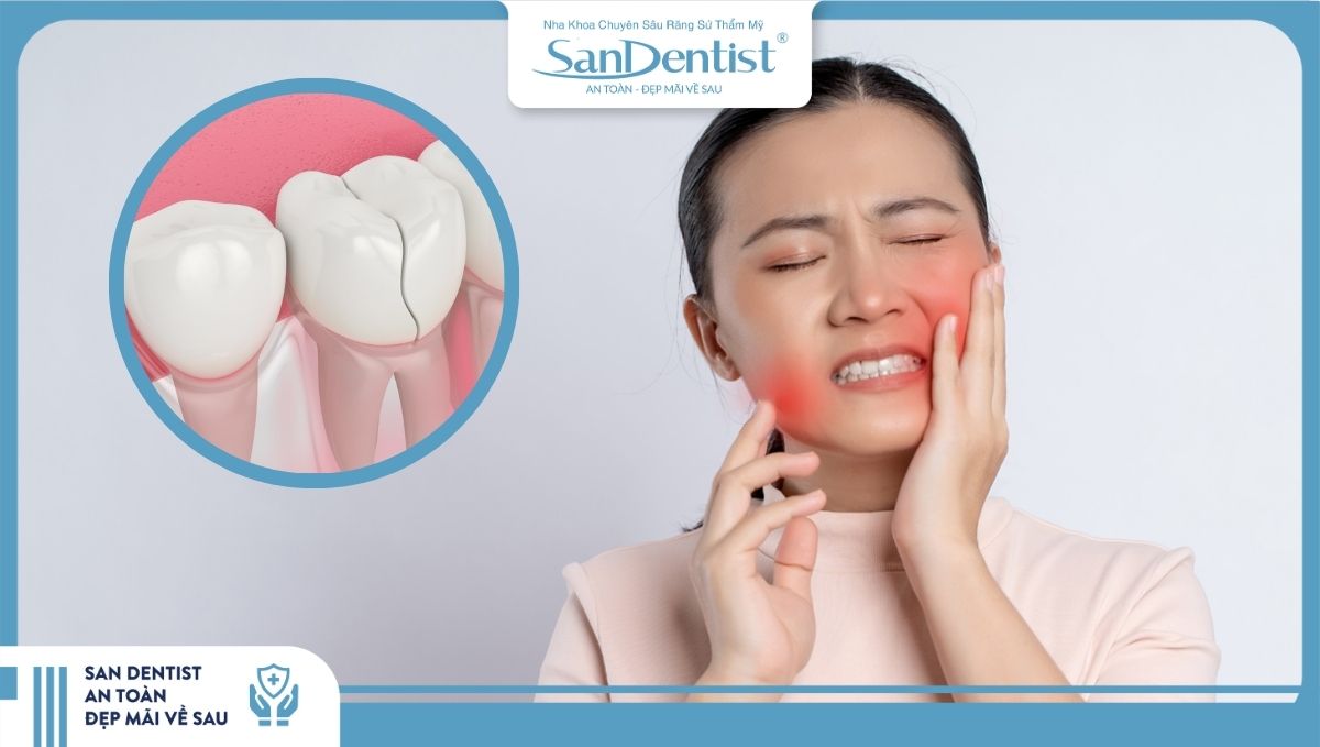 Răng sứ kém chất lượng là nguyên nhân khiến mài răng bọc sứ bị ê buốt