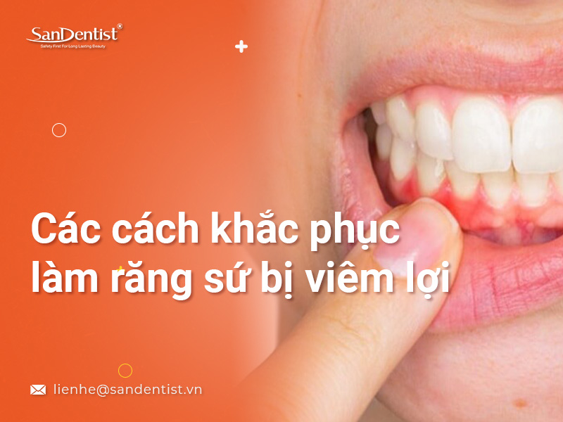 Viêm lợi: Các bức ảnh liên quan tới viêm lợi sẽ giúp bạn hiểu rõ hơn về căn bệnh này và cách điều trị hiệu quả. Hãy cùng khám phá những hình ảnh về phương pháp chăm sóc răng miệng đúng cách, giúp ngăn ngừa và điều trị viêm lợi.