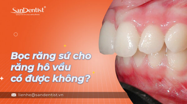 Bọc răng sứ cho răng hô vẩu có được không?