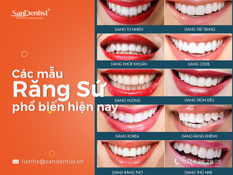 Giải đáp thắc mắc giá bọc răng sứ TPHCM bao nhiêu cùng San Dentist