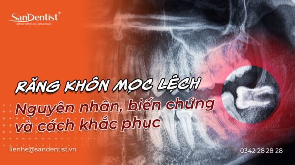Răng khôn mọc lệch: nguyên nhân, biến chứng và cách khắc phục