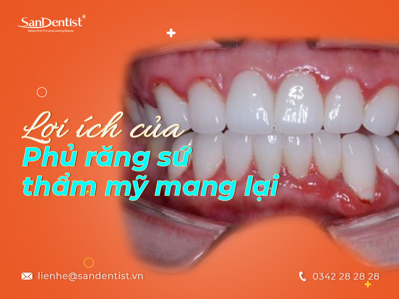 Răng sau bọc sứ bị đau nguyên nhân do đâu?
