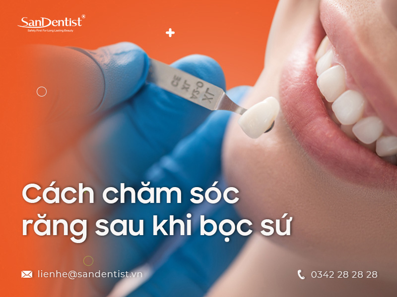 Cảm giác sau khi gắn răng sứ như thế nào cùng chuyên gia giải đáp