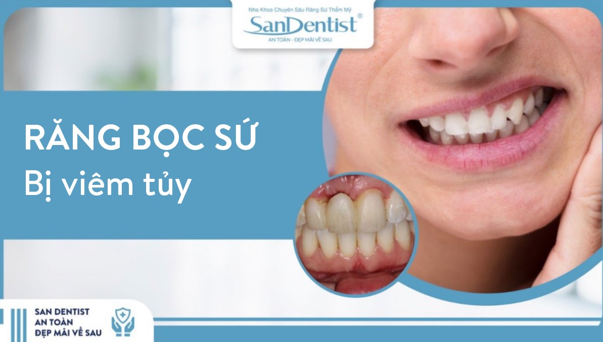 Răng bọc sứ bị viêm tủy