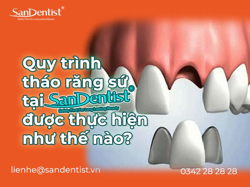 Tháo răng sứ có đau không? Quy trình tháo răng sứ như thế nào?