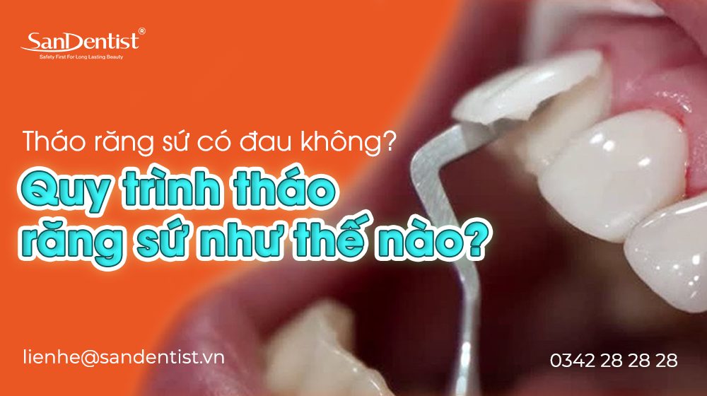 Tháo răng sứ có đau không? Quy trình tháo răng sứ như thế nào?