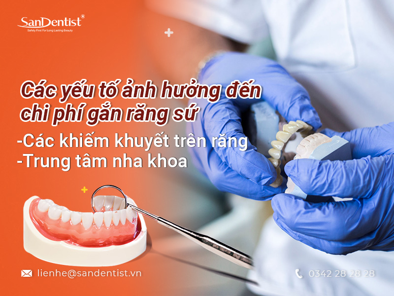 Vai trò và những phụ kiện trong việc cung cấp vật tư điện