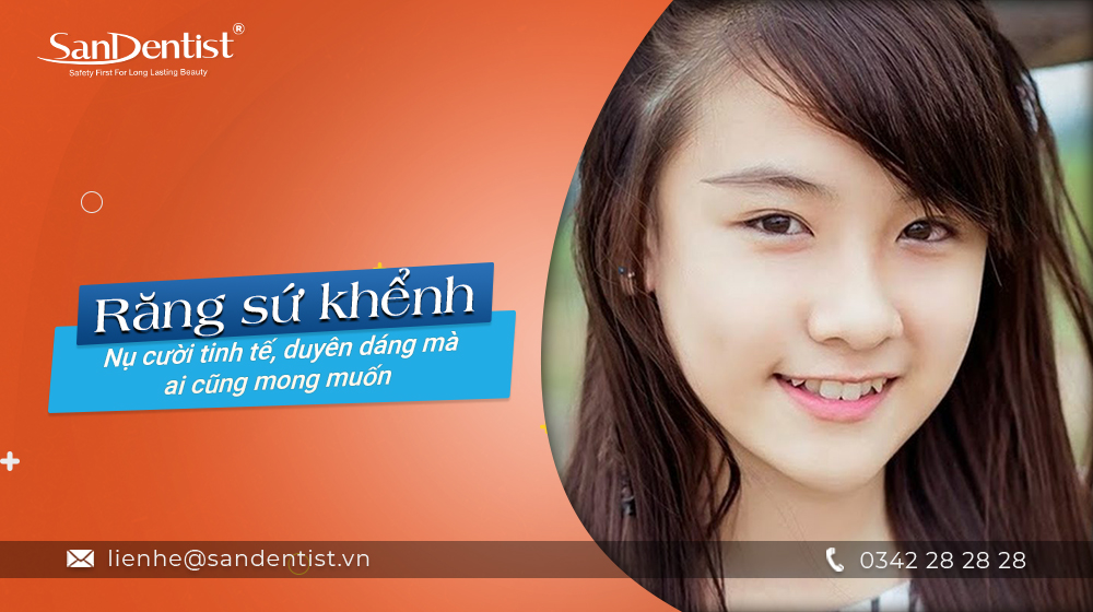 Răng sứ khểnh – Nụ cười tinh tế, duyên dáng mà ai cũng mong muốn