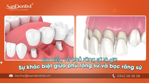 San Dentist - Trung tâm phủ răng sứ uy tín được nhiều khách hàng đánh giá cao