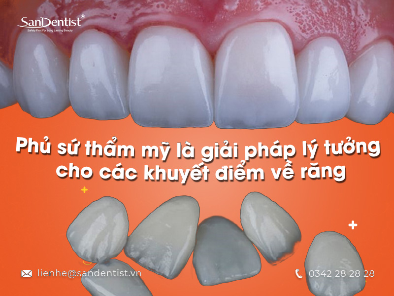 Đầu tư một bộ răng sứ bao nhiêu tiền tại San Dentist?