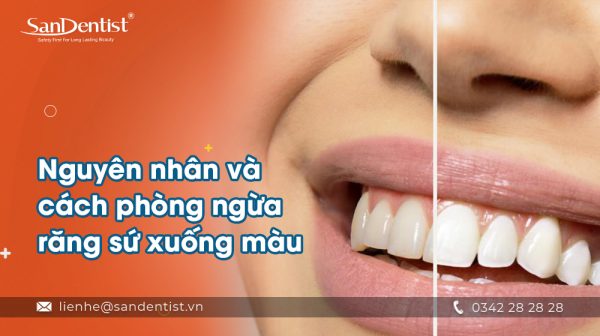 Nguyên nhân và cách phòng ngừa răng sứ xuống màu
