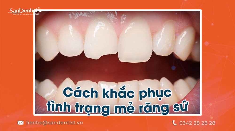 Mẻ răng sứ phải làm sao để khắc phục?