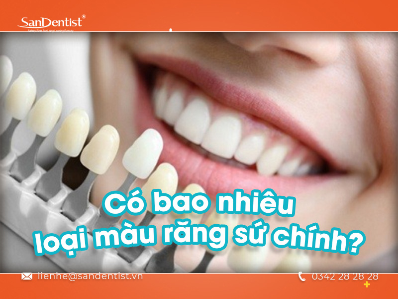 Răng sứ quá trắng liệu có hoàn hảo? Bật mí cách lựa chọn màu sắc răng phù hợp