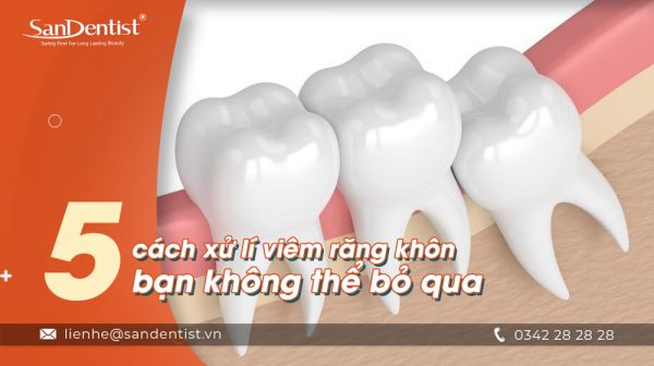 5 cách xử lý viêm răng khôn bạn không thể bỏ qua