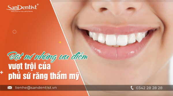 Bật mí những ưu điểm vượt trội của phủ sứ răng thẩm mỹ