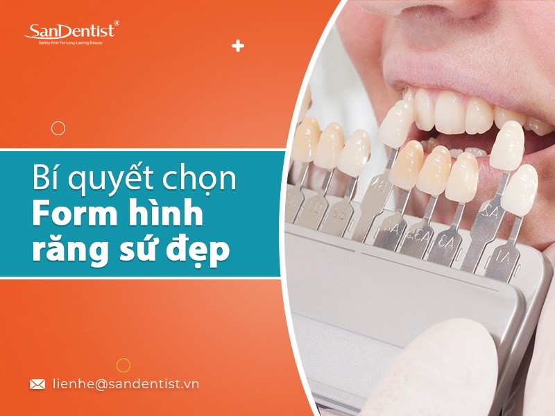 Mách bạn bí quyết chọn hình răng sứ đẹp!
