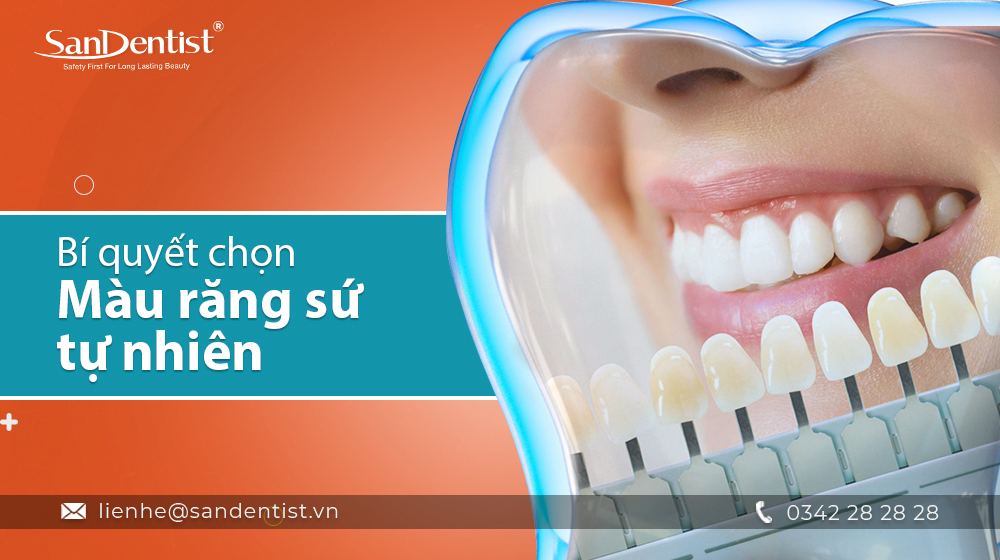 Đánh giá các yếu tố giá trị và chi phí của việc lựa chọn răng sứ đẹp?
