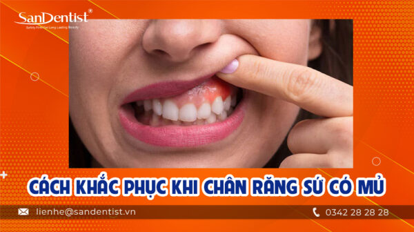 Cách khắc phục khi chân răng sứ có mủ